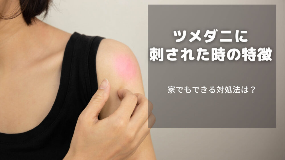 効果的なツメダニ対策・駆除方法!刺された時の見分け方や対処法を徹底解説